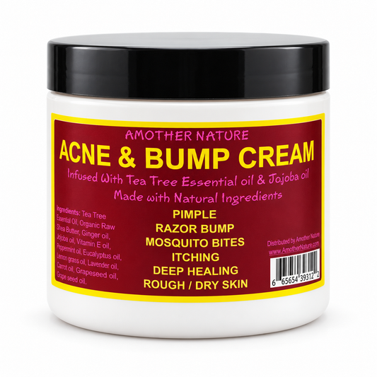 Acne & Bump Cream – Tea Tree & Jojoba Oil